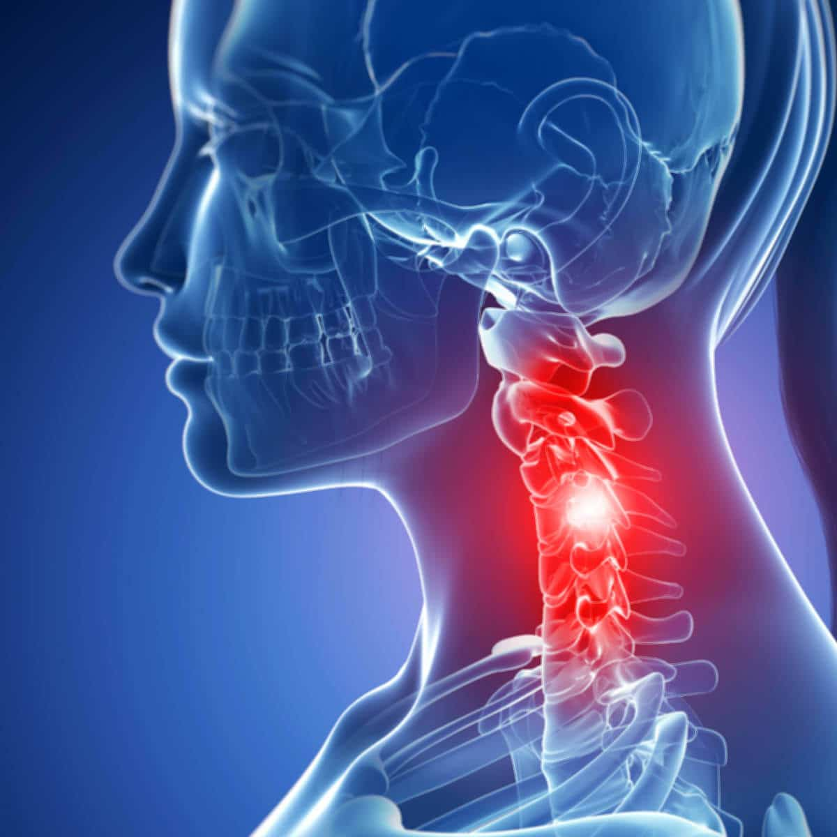 How to Release a Pinched Nerve in Your Shoulder at Home