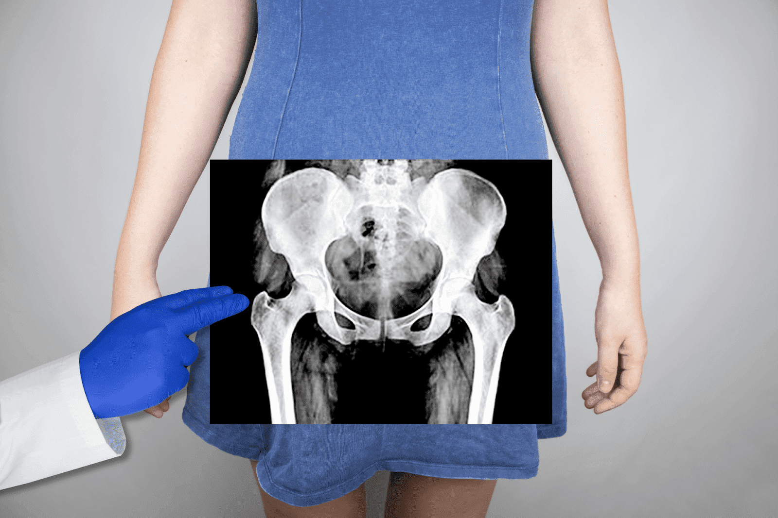 A doctor points to a pelvic X-ray image over a person’s lower body.