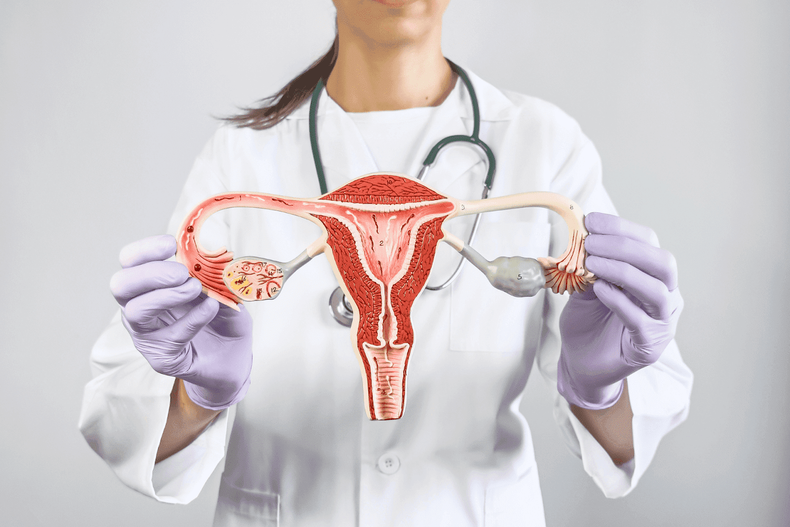 A healthcare professional holding a model of the female reproductive system, representing PCOS or reproductive health.