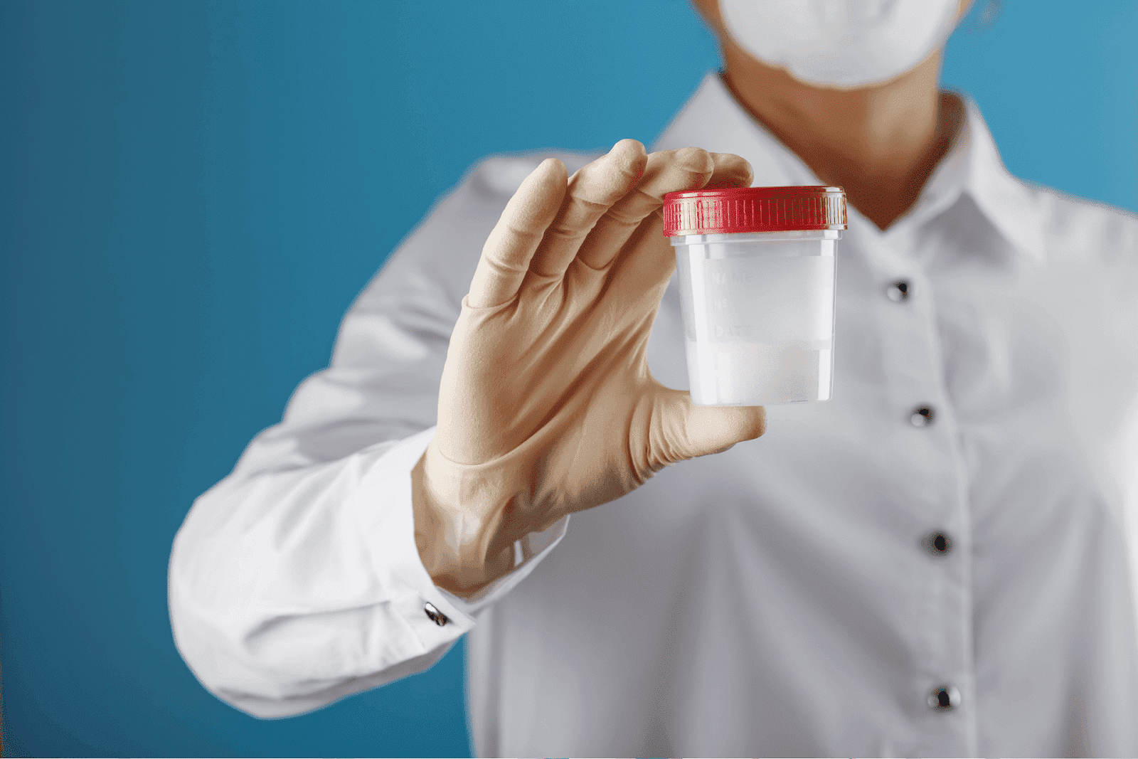 A medical professional holding a transparent specimen container with a red lid, used for sample collection.