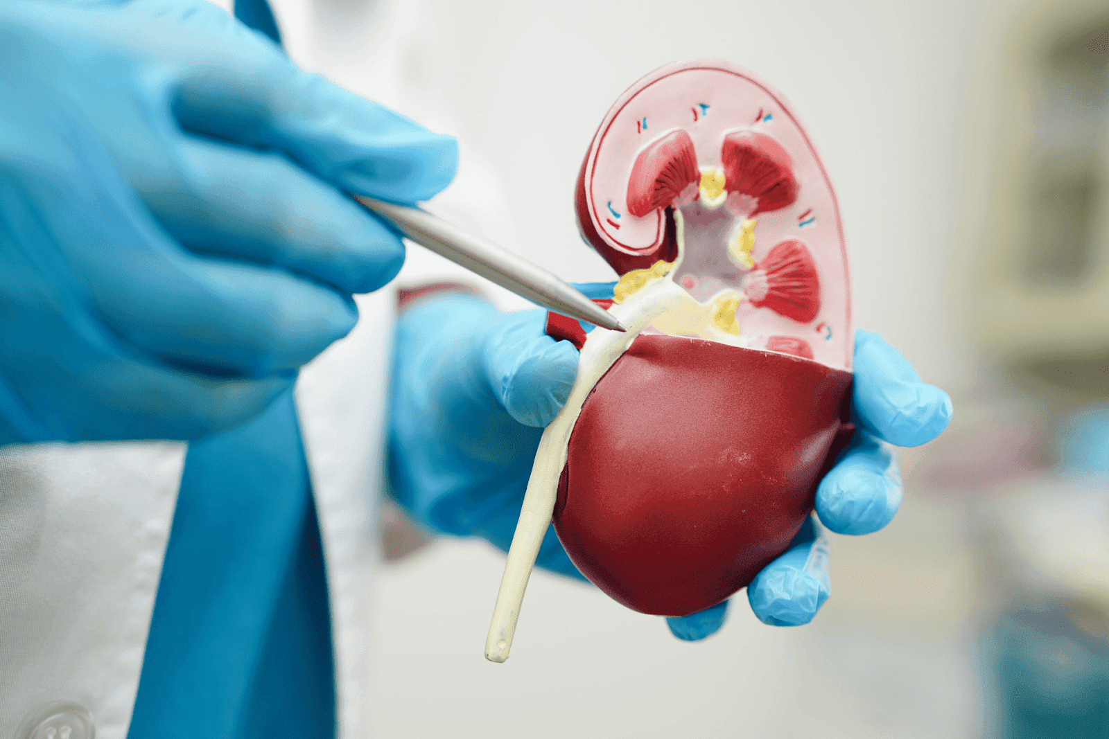 A medical professional wearing blue gloves points at a kidney model with forceps.