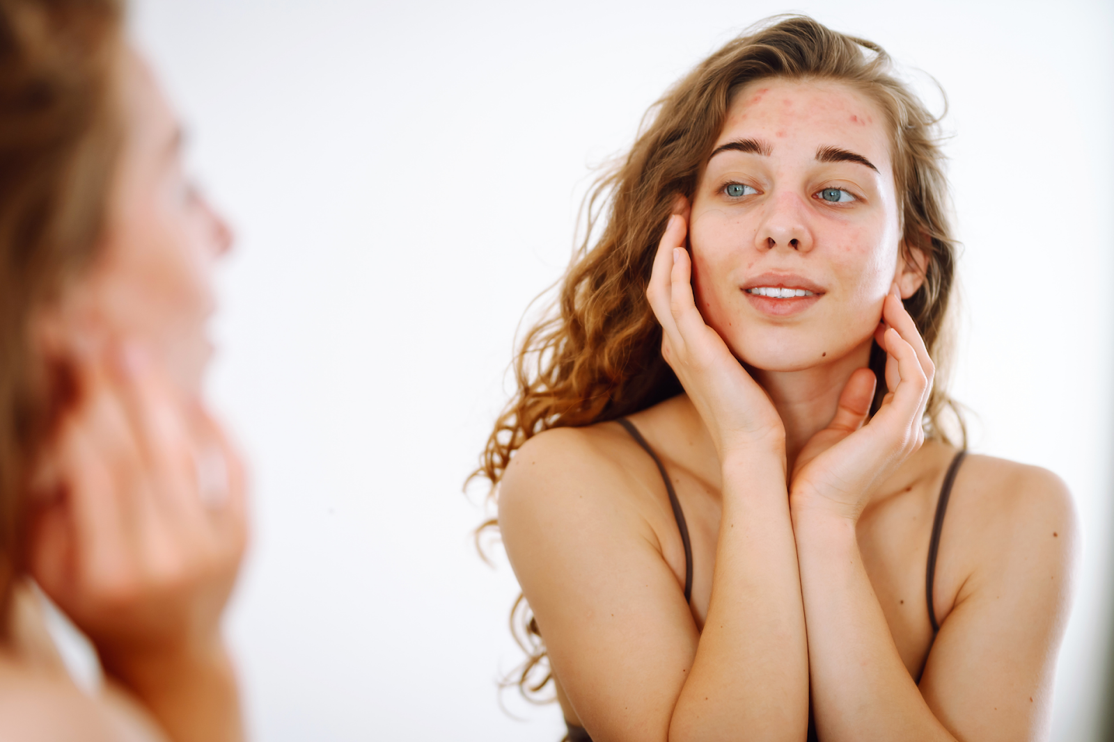 A young woman looking in a mirror, touching her face and examining acne and redness on her cheeks and forehead.