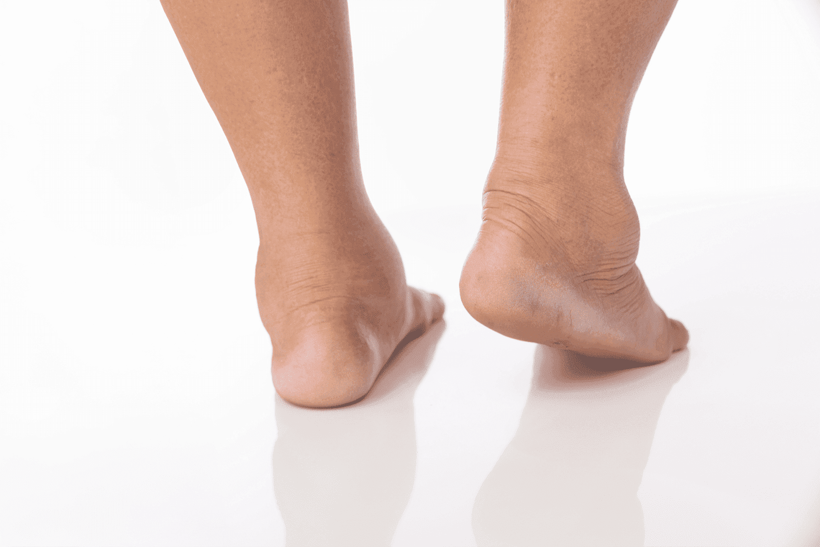 Swollen Ankles? Here’s What Might Be Causing It