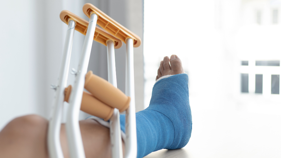 Lower leg with cast on and crutches