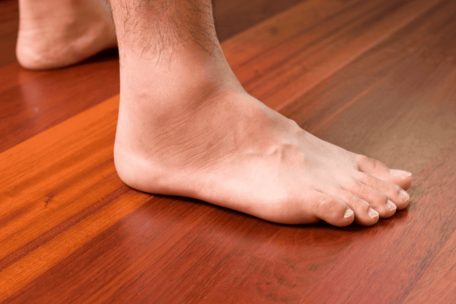 Close-up of a person’s bare foot with swollen ankles standing on a wooden floor