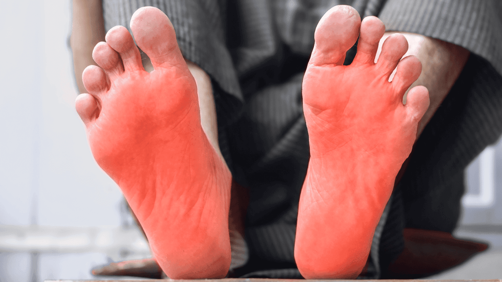 Close-up of a person’s feet with red discoloration on the soles, indicating inflammation or pain.