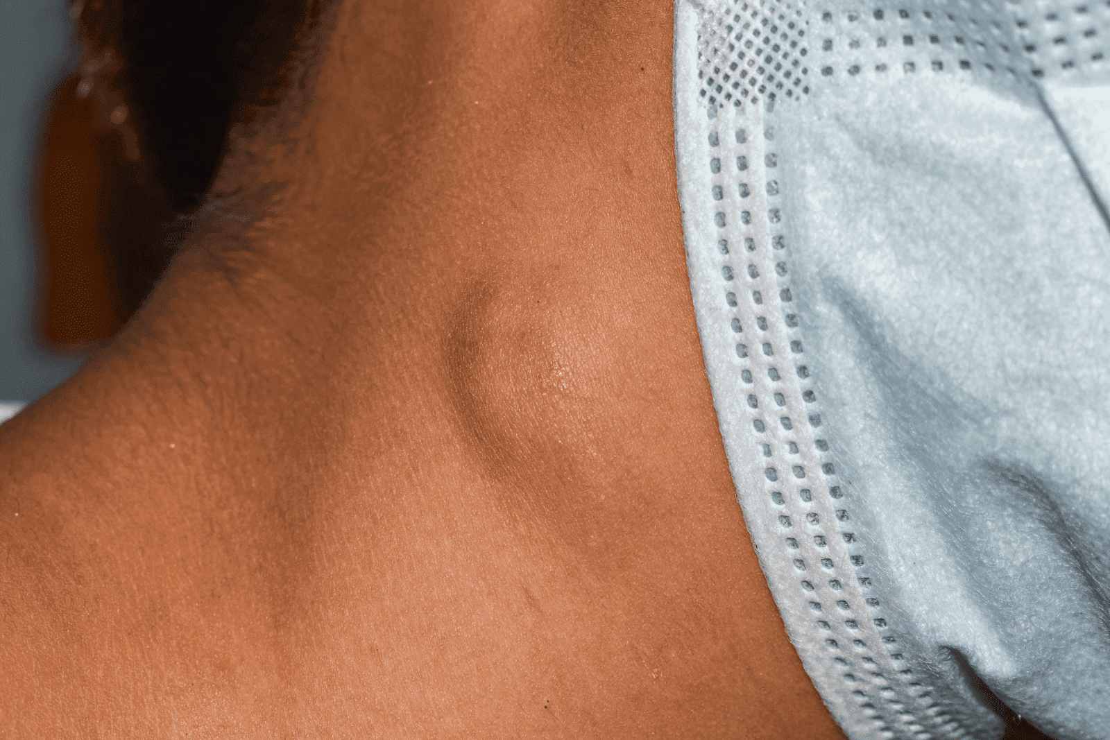 Lump Under Your Chin? It Might Not Be What You Think