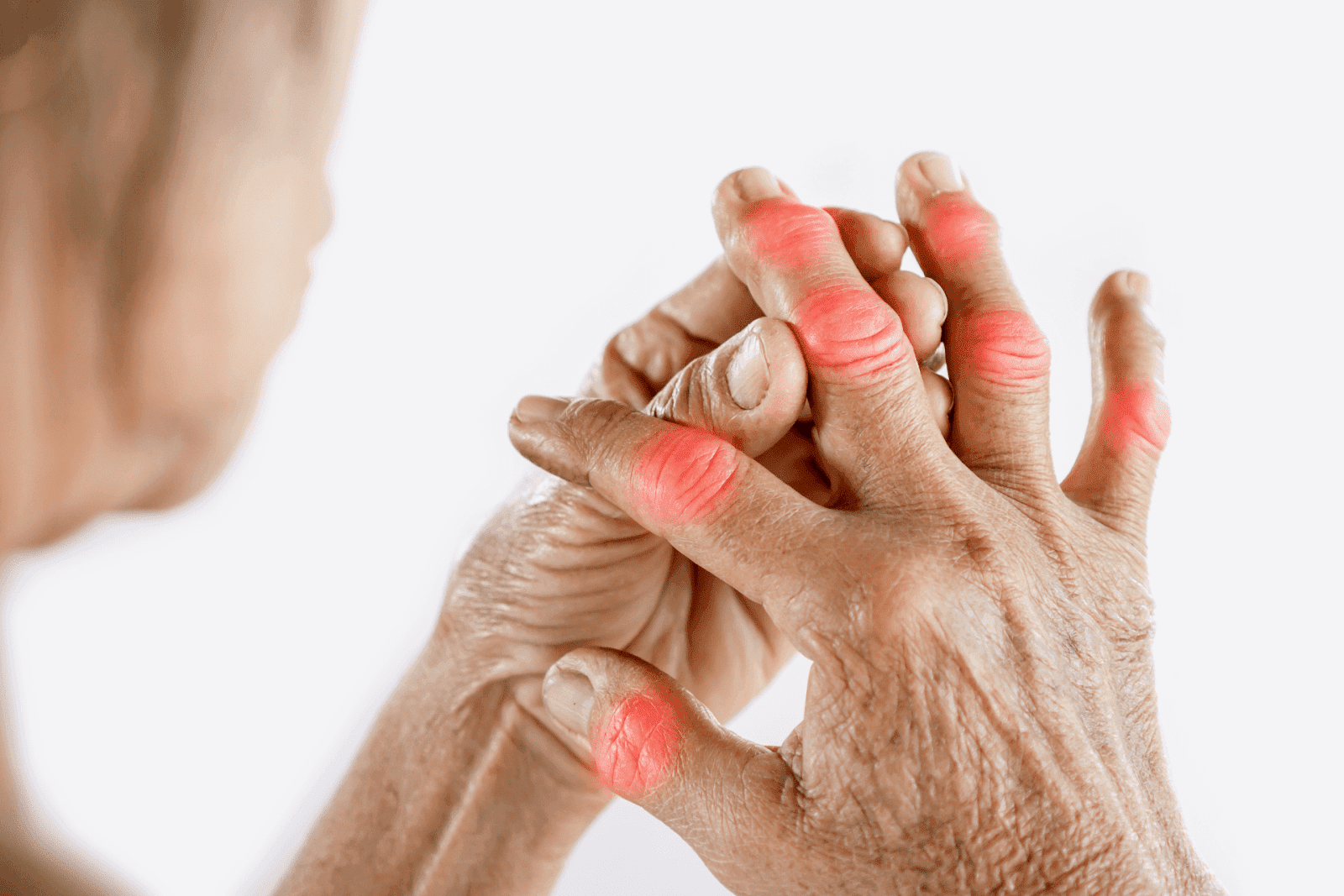Achy Joints? Here’s What to Know About Arthritis Symptoms