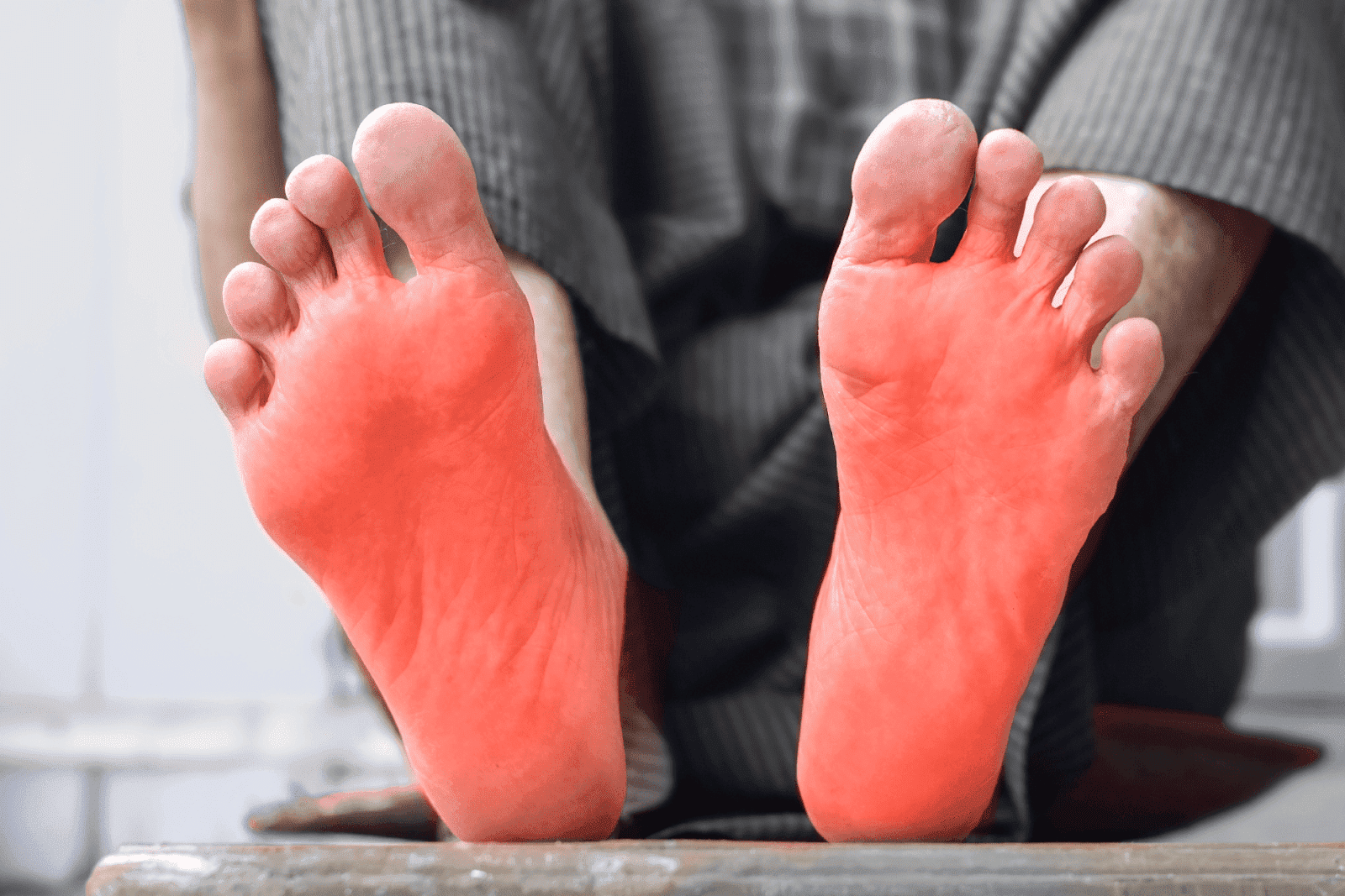 Close-up of inflamed feet with redness on soles