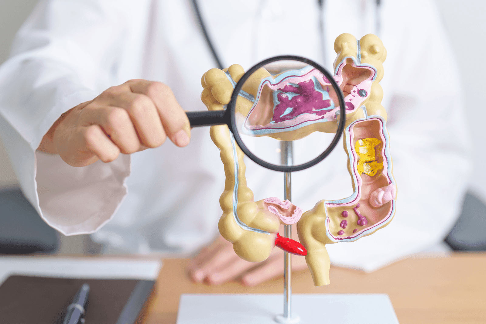 Doctor examining a colon model with a magnifying glass.
