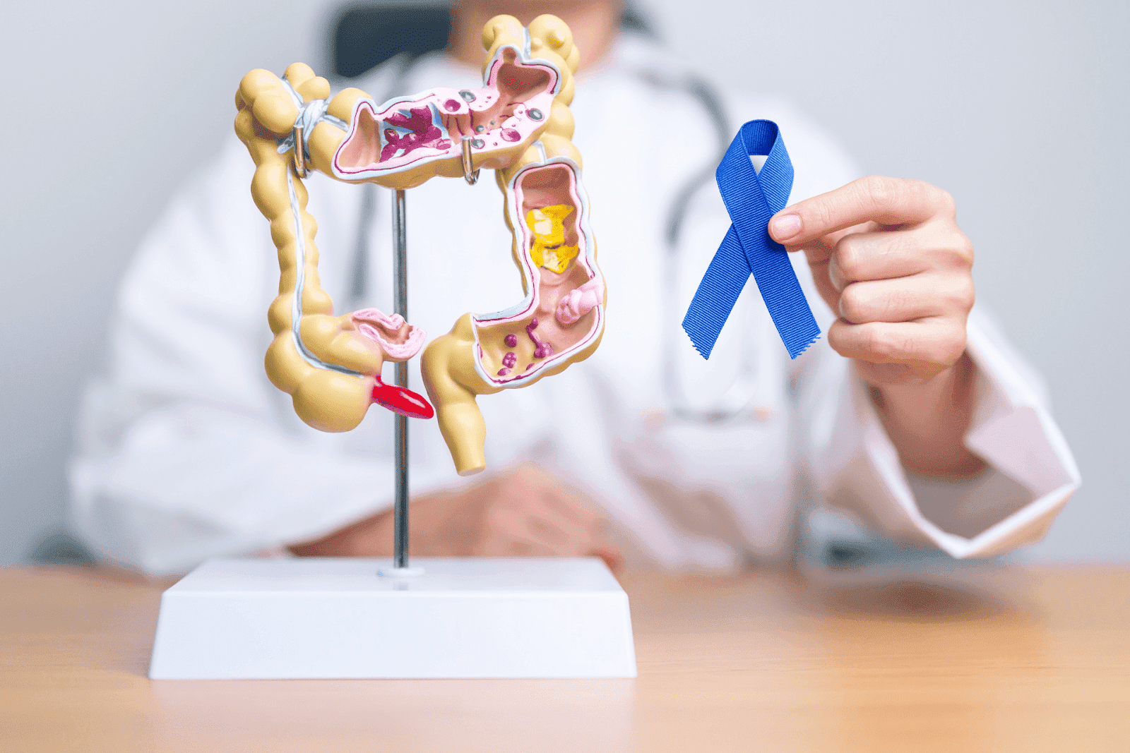 Doctor holding a blue awareness ribbon next to a model of the human colon, symbolizing colorectal cancer awareness.