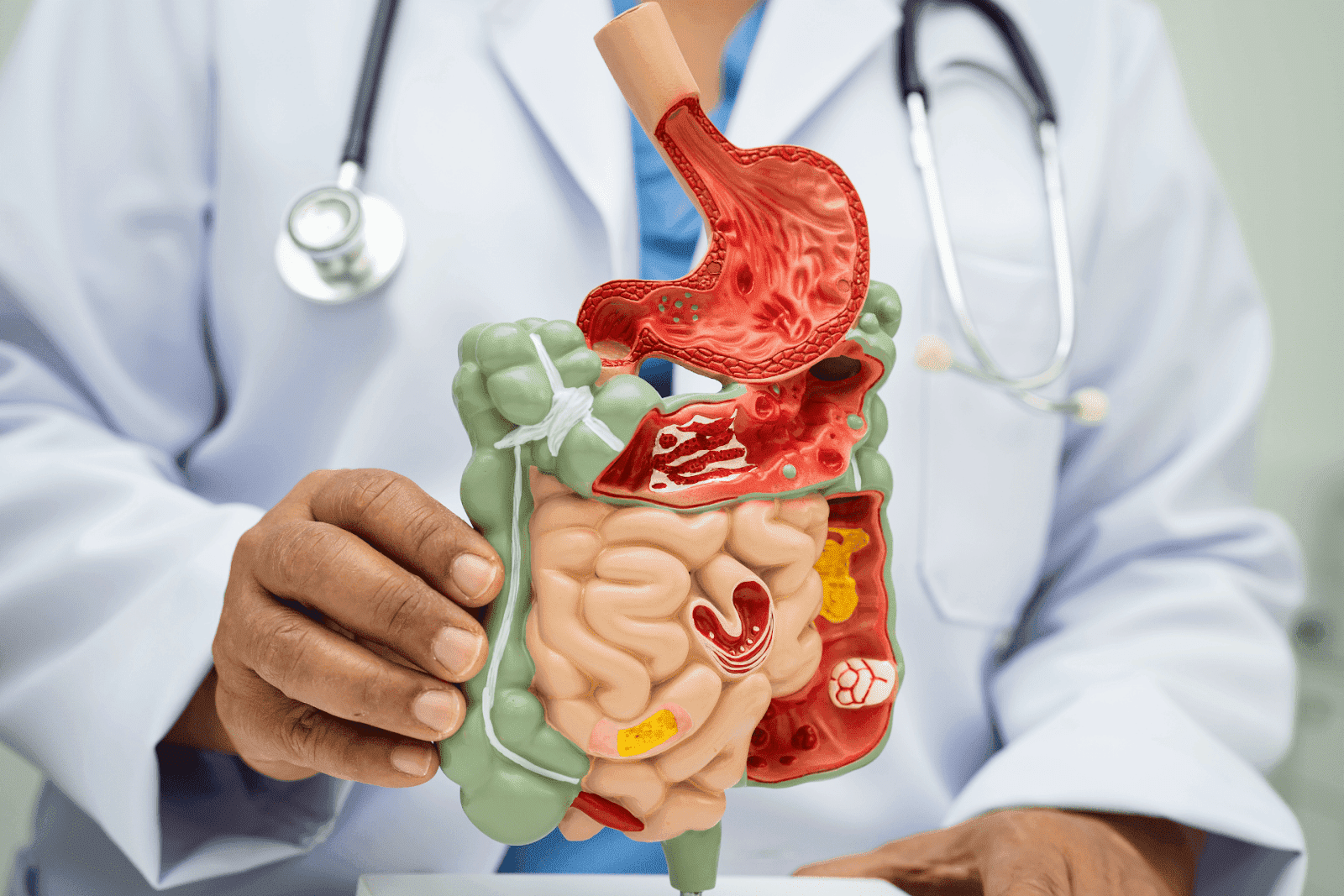 Bowel Problems That Won’t Go Away? Here’s What to Check