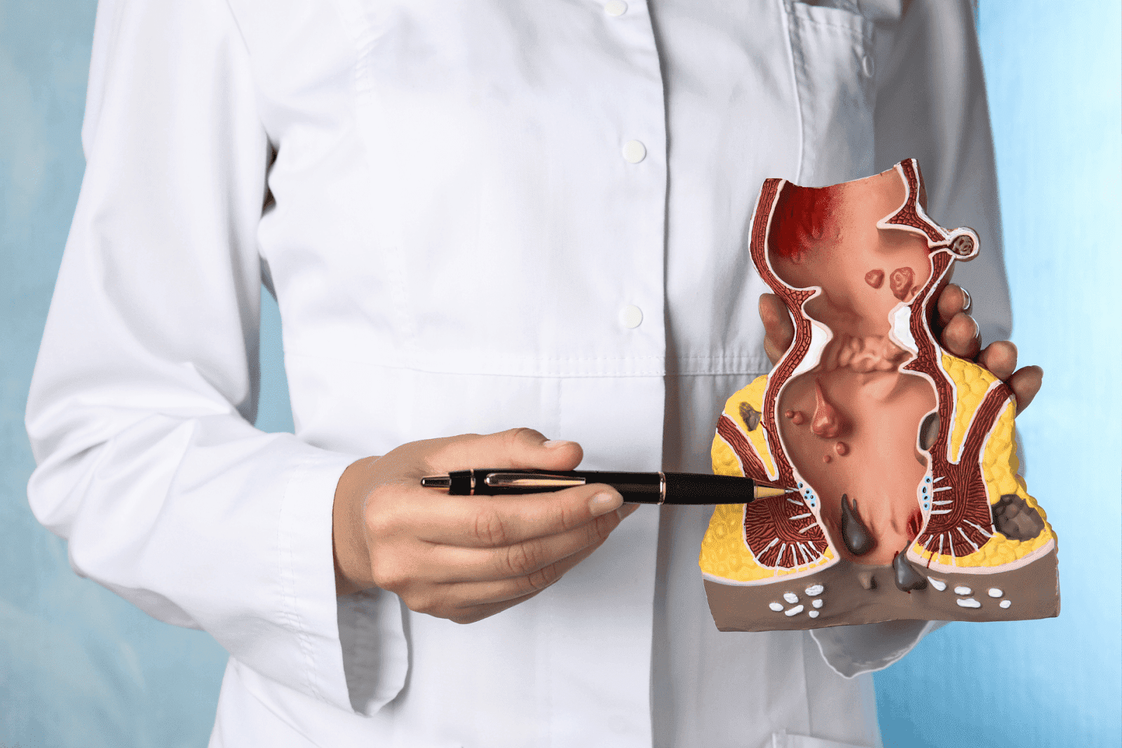 Blood in Your Stool? Here's Why You Shouldn’t Ignore It