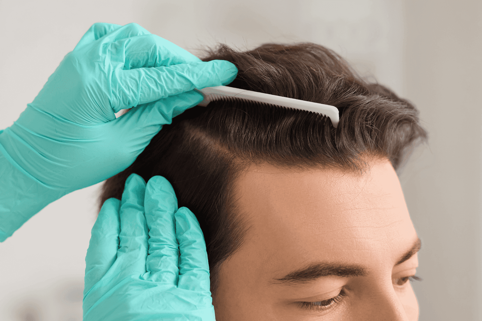 Doctor wearing gloves examining a patient’s scalp with a comb