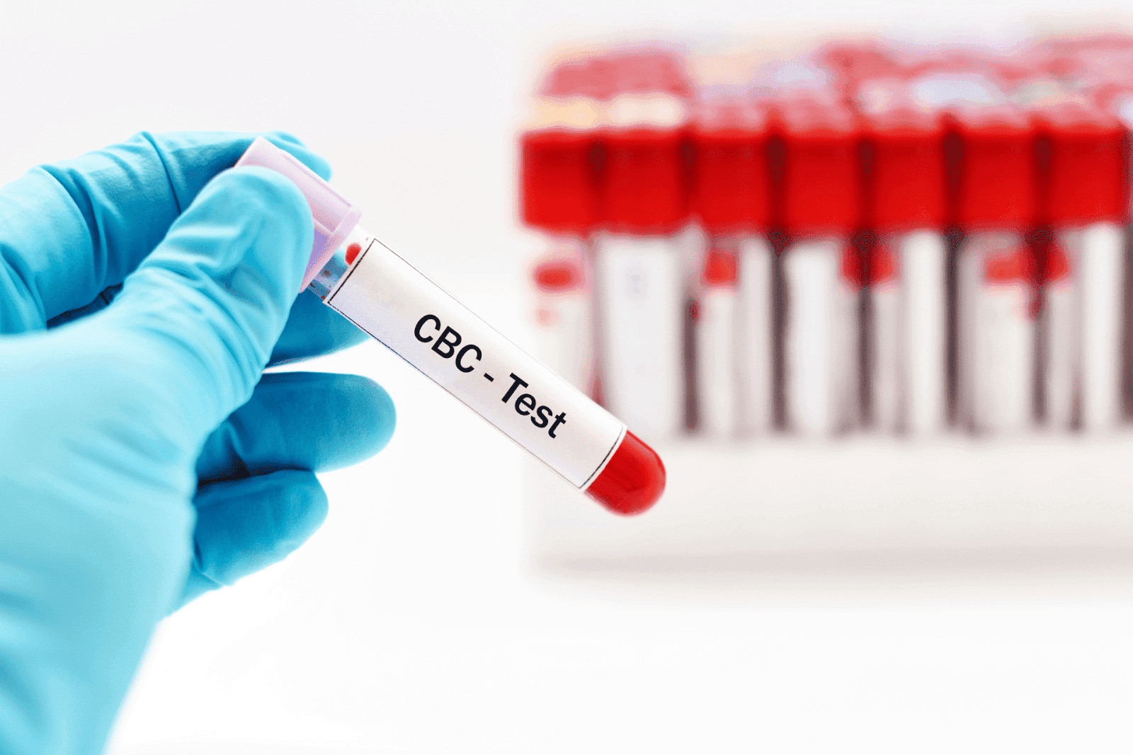 Gloved hand holding a test tube labeled "CBC - Test" with other blood samples in the background.