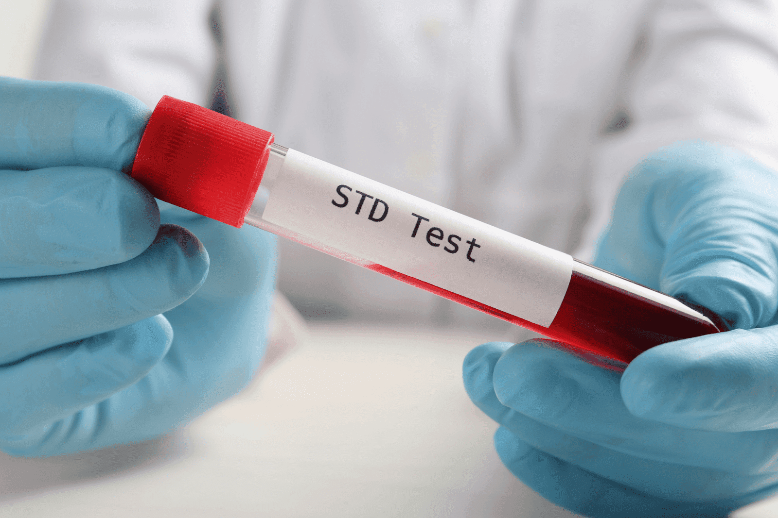 Gloved hands holding a blood sample tube labeled "STD Test."
