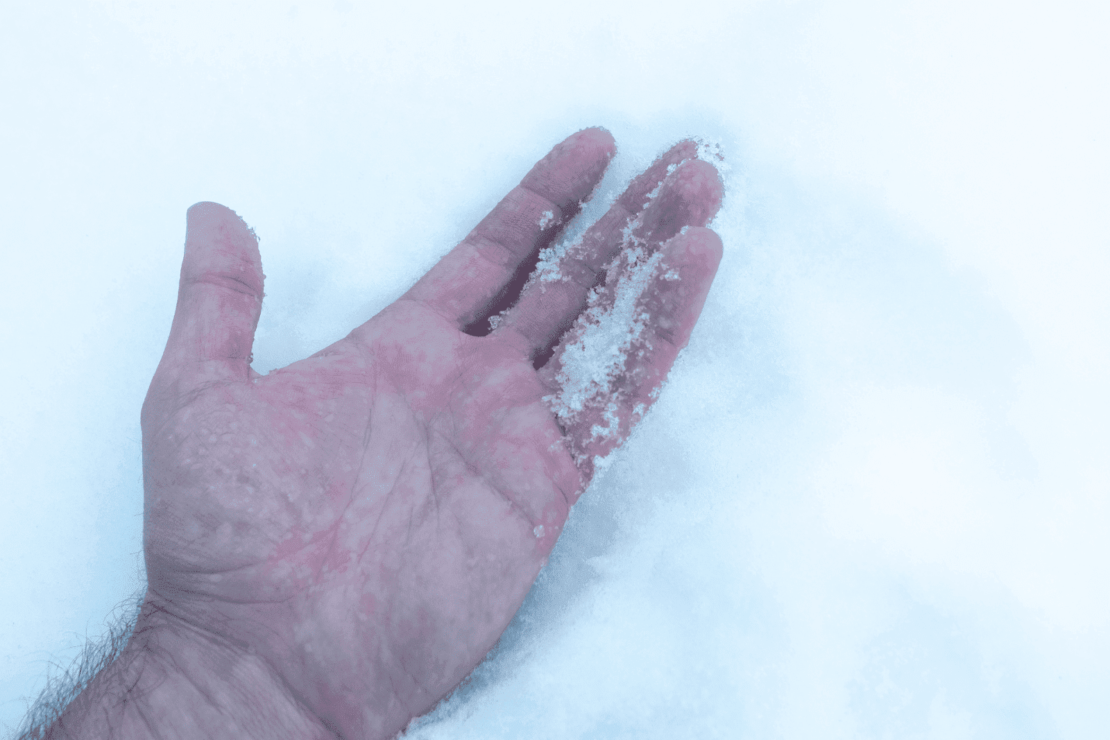 Hand holding snow, showing signs of cold exposure.
