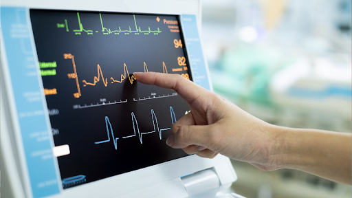 Heart monitor showing EKG results