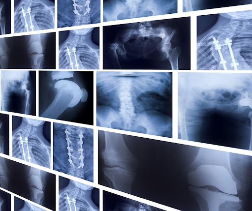 Does Urgent Care Do X-Rays?