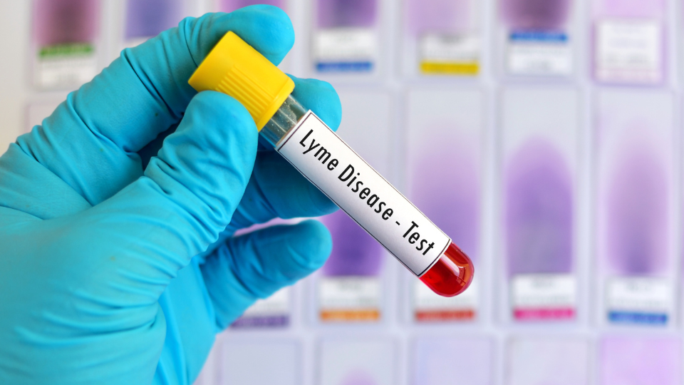 Can Urgent Care Test for Lyme Disease?