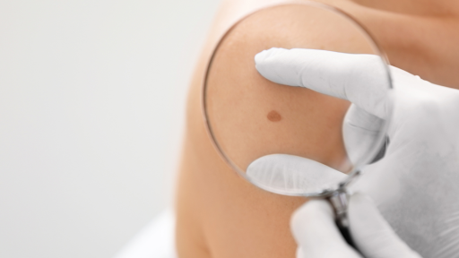 Can Dermatology Issues Be Treated at Urgent Care?