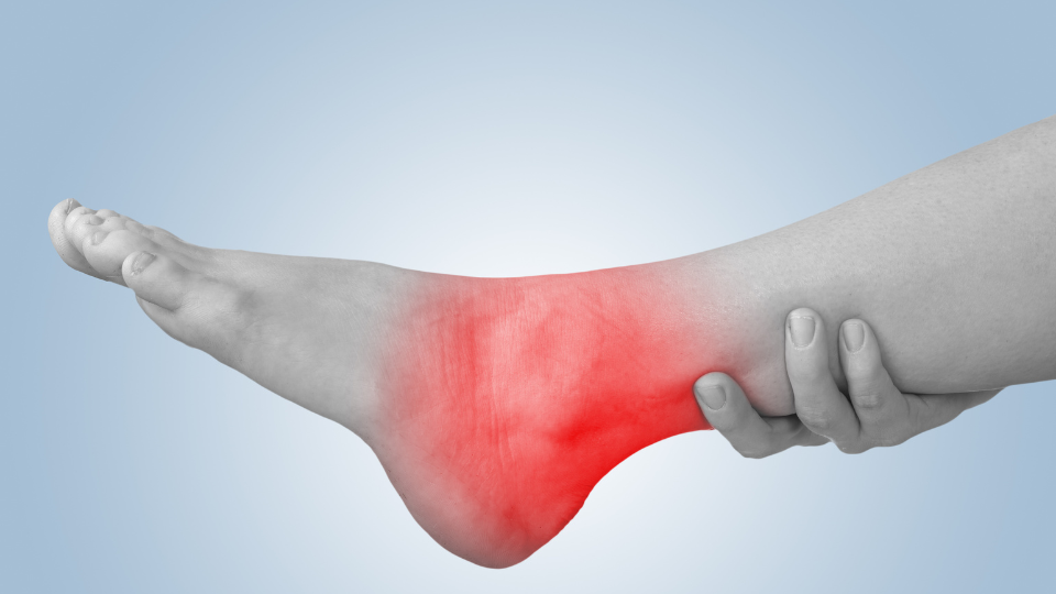 Should I Go to Urgent Care for a Sprained Ankle?