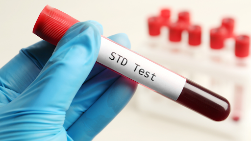 Does Urgent Care Do STD Testing?