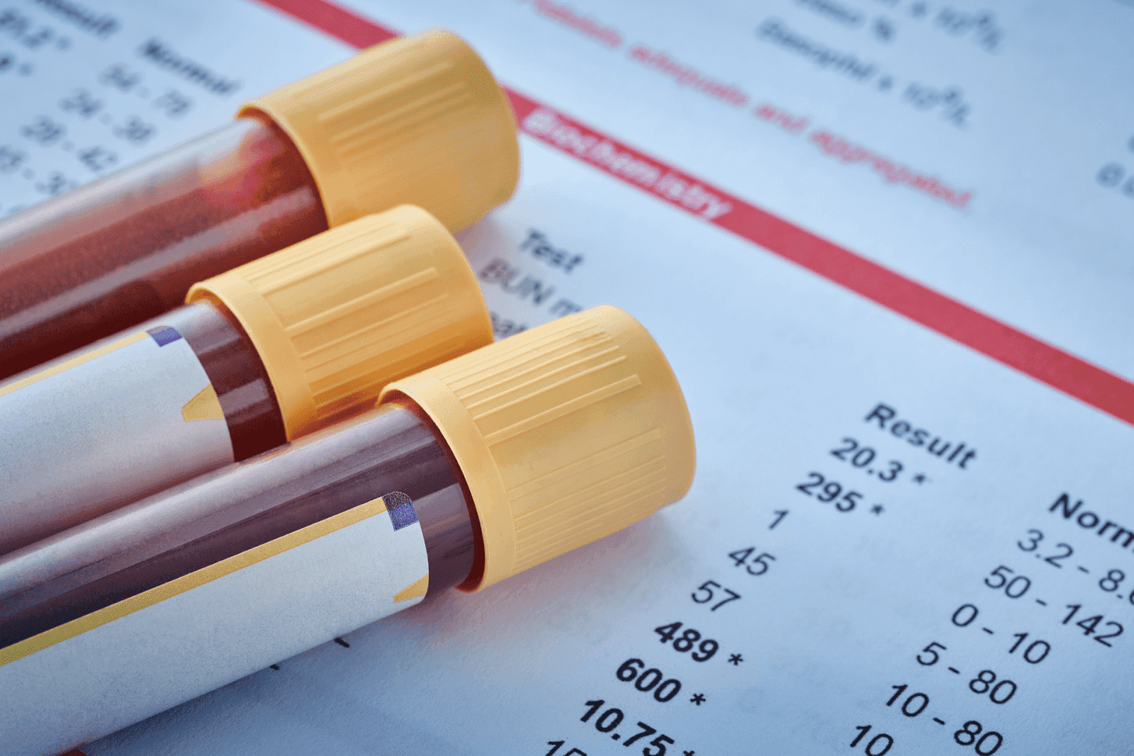 Three blood sample tubes on top of lab test results