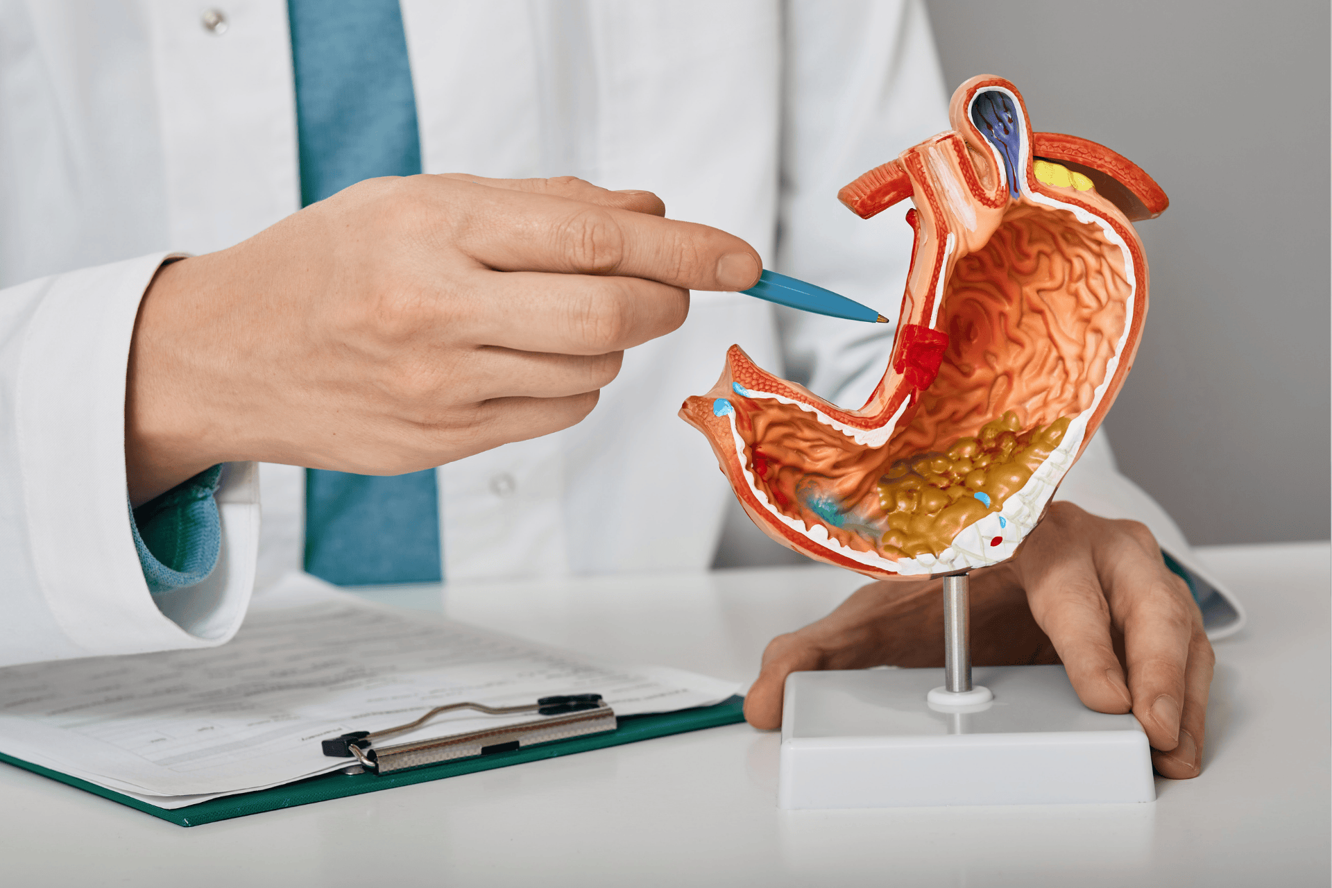 Doctor pointing at a model of the human stomach with a pen.