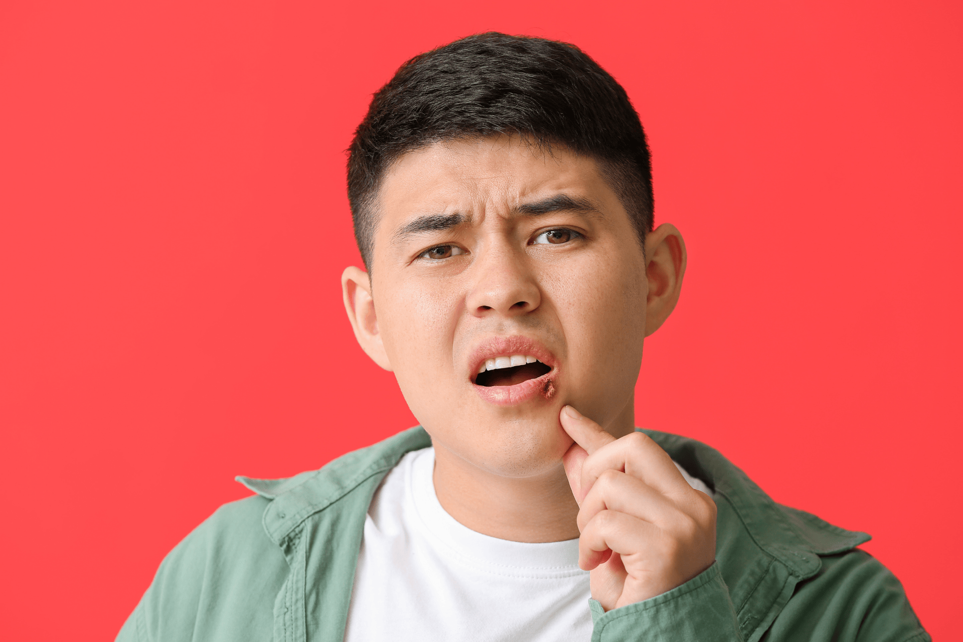 Man pointing to a sore on his lower lip against a red background.