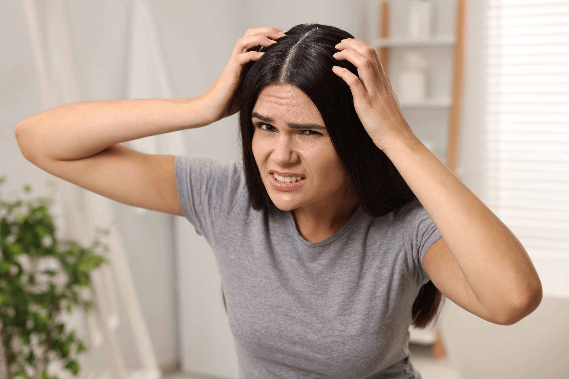 Woman scratching her scalp while looking uncomfortable.