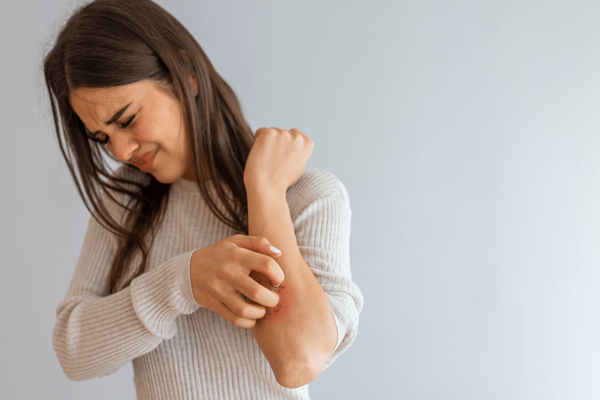 Woman scratching a red, irritated eczema patch on her elbow, looking uncomfortable.