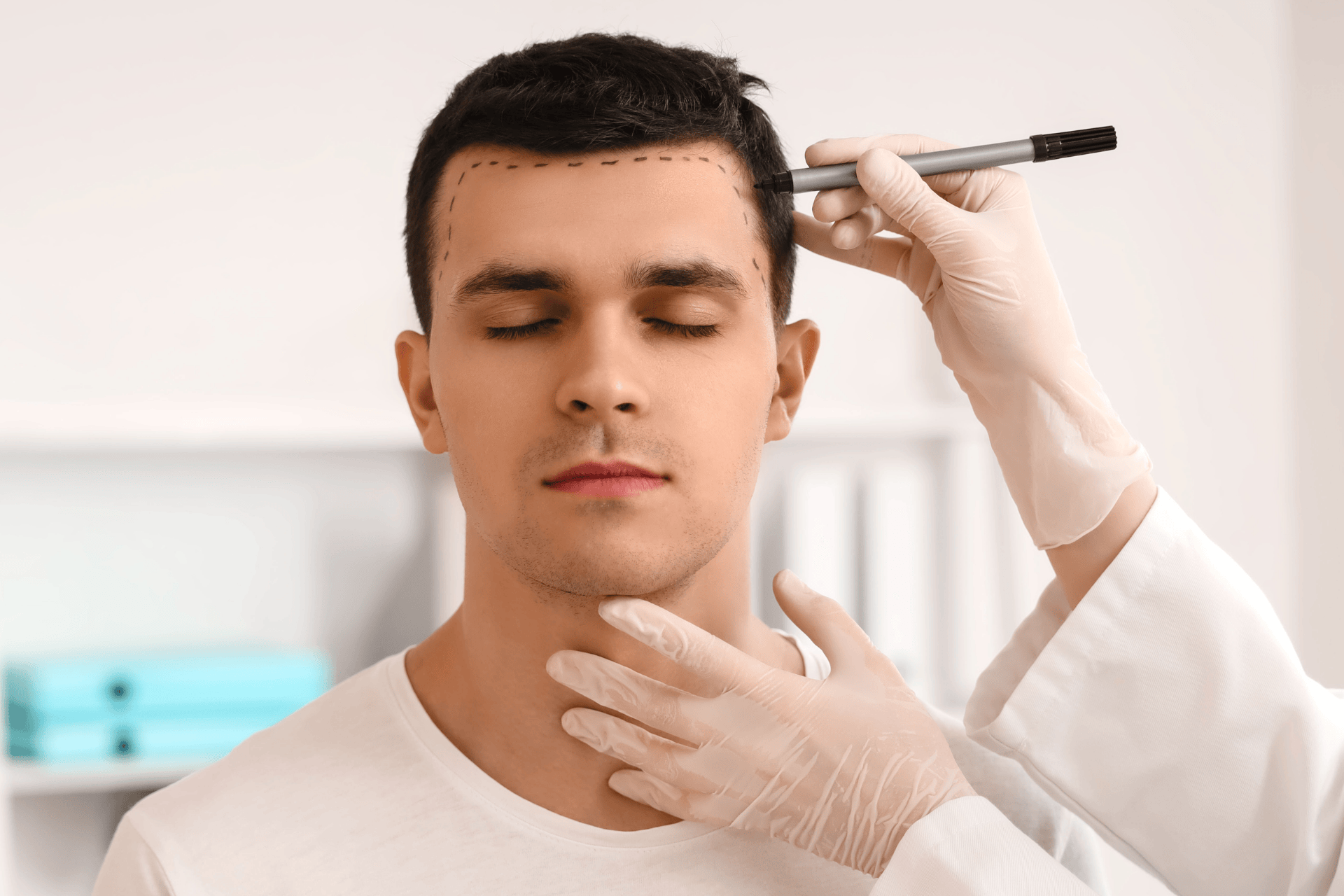 A man with eyes closed while a clinician marks his hairline before a hair transplant procedure.