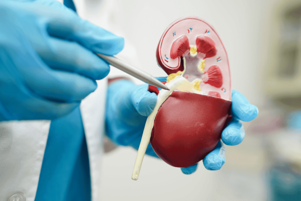 A medical professional wearing blue gloves points at a kidney model with forceps.