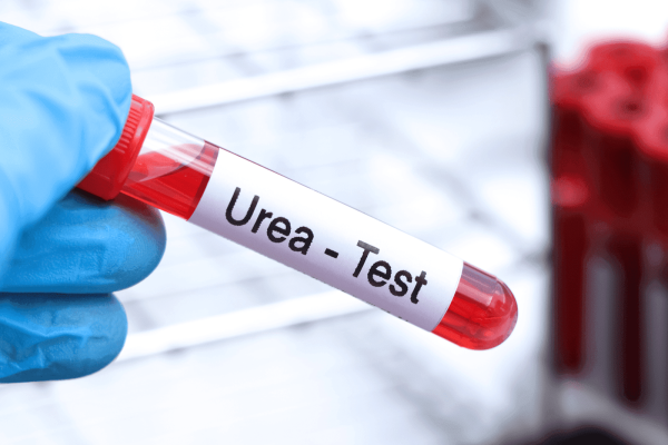 Hand in a blue glove holding a blood sample tube labeled “Urea - Test”