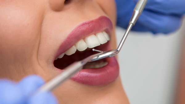 Close up of teeth being checked by dentist