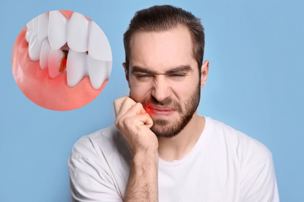 Man Suffering from Extreme Toothache